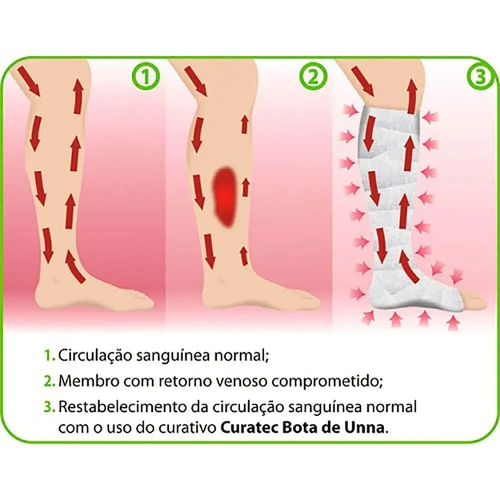 Curatec Bota de Unna Cuidadores BH